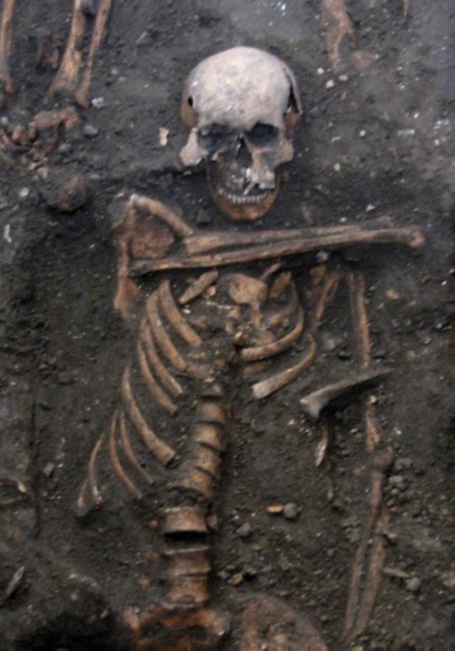 The Skeleton of a young adult male is buried on the grounds of a medieval charitable hospital in Cambridge, U.K. One of the samples of ancient herpes DNA came from a young adult male from the late 14th century, buried on the grounds of medieval Cambridge’s charitable hospital (later to become St. John's College), who had suffered appalling dental abscesses - Image Credit: Craig Cessford/Cambridge Archaeological Unit.
