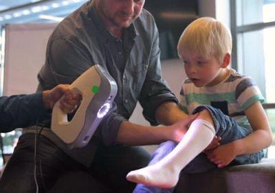 AbilityMate 3D-prints ankle and foot orthoses for children with disabilities - Photo Credit: AbilityMate.