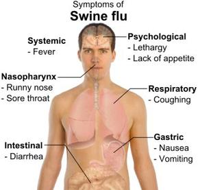 Diagram of Symptoms of Swine Flu (H1N1)