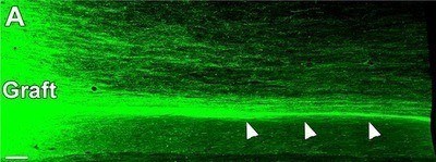 Large numbers of human, green fluorescent protein-expressing axons emerge from a lesion/graft site and grow caudally in linear arrays. Many axons travel along the interface (indicated by arrows) between spinal cord white matter (nerve fibers covered with myelin) and spinal cord gray matter (nerves without the whitish myelin sheathing) - Image courtesy of Mark Tuszynski, UC San Diego School of Medicine.