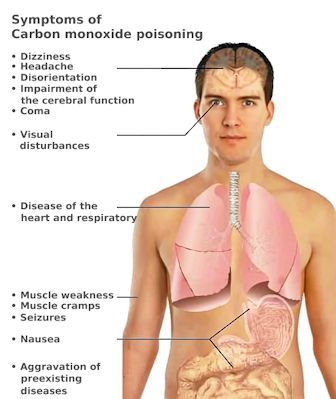 List of CO toxicity symptoms.