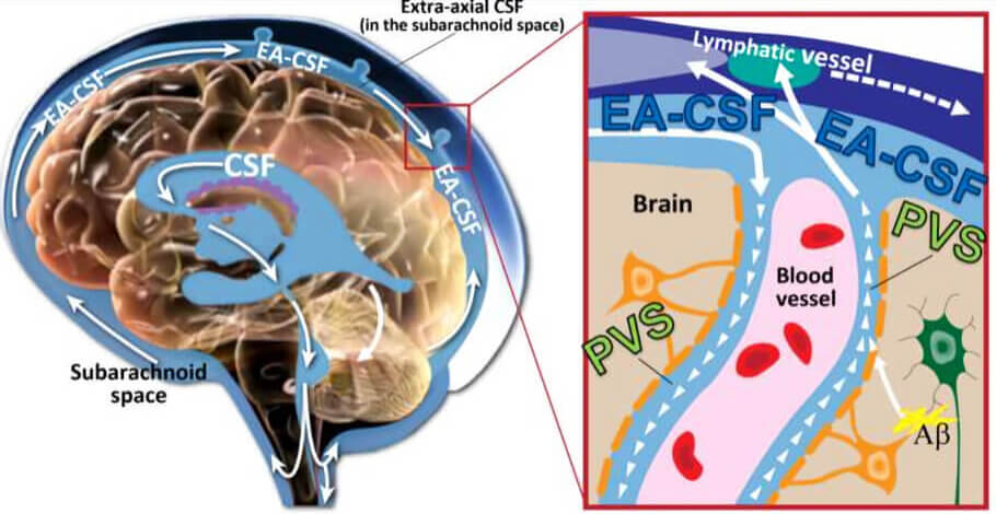 CSF normally flows continuously throughout the extra-axial and perivascular spaces, where it filters out inflammatory proteins, before draining efficiently from the extra-axial space - Image Credit: Dea Garic and Mark Shen.