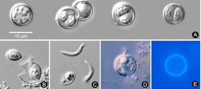 Infected people shed unsporulated (non-infective; immature) Cyclospora cayetanensis oocysts in their stool; immature oocysts usually require at least 1 to 2 weeks under favorable laboratory conditions to sporulate and become infective. An unsporulated oocyst, with undifferentiated cytoplasm, is shown (far left), next to a sporulating oocyst that contains two immature sporocysts (A). An oocyst that was mechanically ruptured has released one of its two sporocysts (B). One free sporocyst is shown as well as two free sporozoites, the infective stage of the parasite (C). Oocysts (D) are auto-fluorescent when viewed under ultraviolet microscopy (E). (Image Credit: CDC/DPDx)