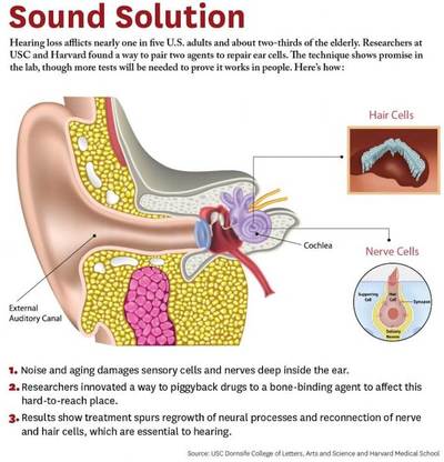 Restoring Hearing for Millions of Elderly and Others with Hearing Loss thumbnail image.