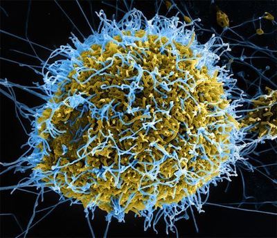 Colorized transmission electron micrograph (TEM) of the Ebola virus. Photo: Frederick A. Murphy, via the Centers for Disease Control and Prevention
