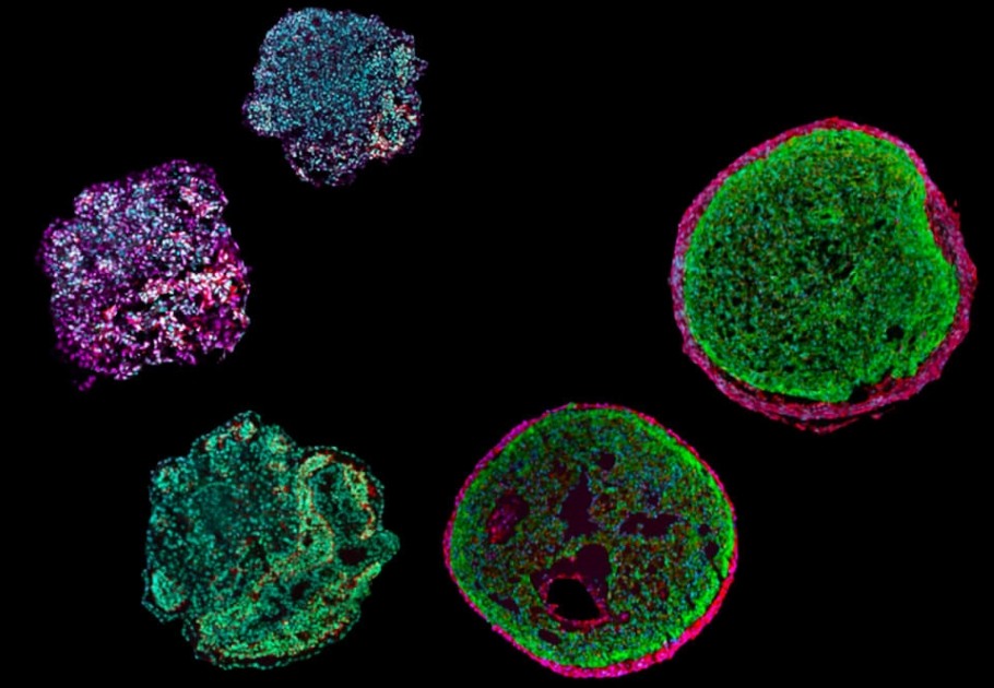 Image of a mini-heart known as an organoid. The heart organoid will permit the study of the earliest development phase of our heart and facilitate research on diseases - Image Credit: Alessandra Moretti / TUM.