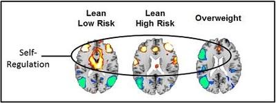 Fig 1. Increased brain activity when viewing food cues shown in yellow, orange, and red. Decreased activity is shown in blue. Activations are present in circuits that support self-regulation and attention (frontal cortex, anterior cingulate, and basal ganglia). Image Credit: Bradley Peterson, M.D., Children's Hospital Los Angeles.