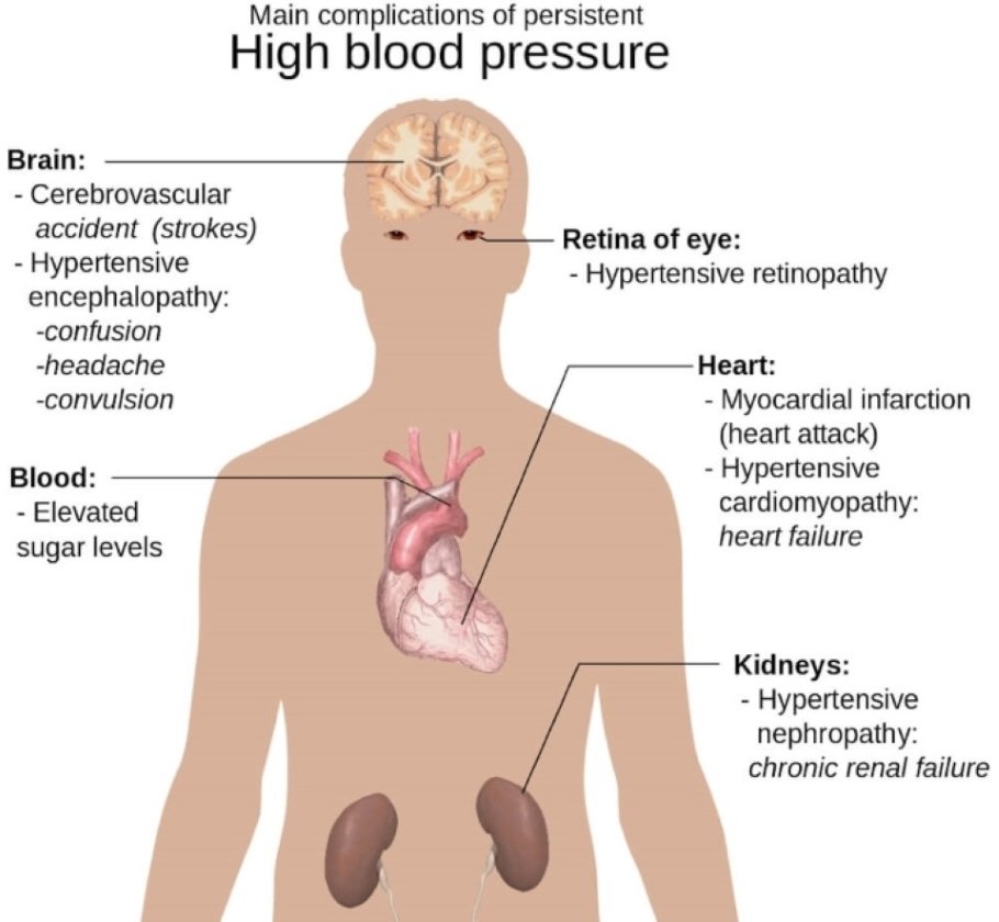 Diagram of the upper human body showing possible complications of high blood pressure.