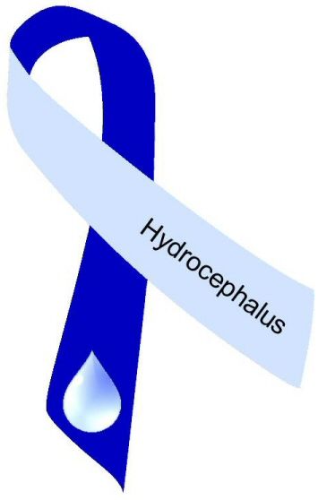 Image of the Hydrocephalus awareness ribbon which is light blue and dark blue with a drop of water on it, and the word Hydrocephalus printed lengthwise on the light blue side.