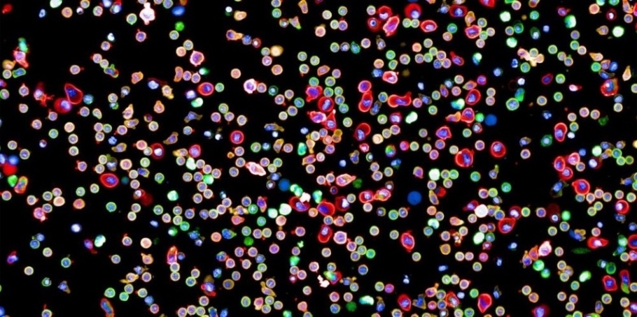 Image showing immune cells - Image Credit: Yannik Severin, Julien Mena, Berend Snijder / ETH Zürich.