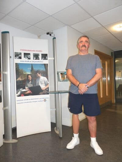 Jim Bruce displays his C-Leg microprocessor knee from Ottobock