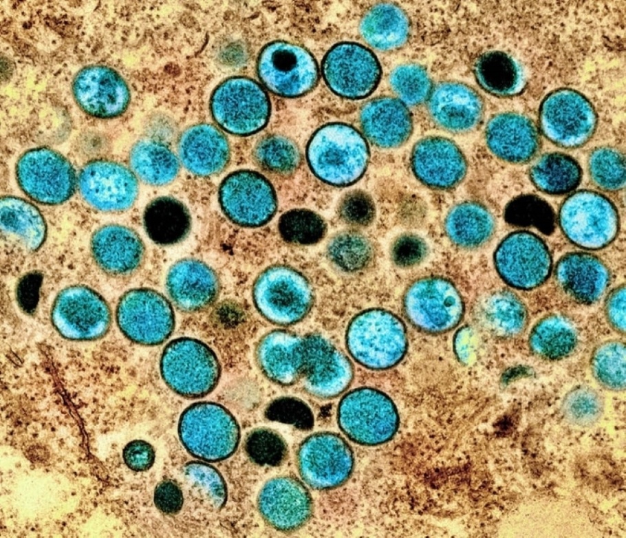 Colorized transmission electron micrograph of monkeypox particles (teal) found within an infected cell (brown) cultured in the laboratory. Image captured and color-enhanced at the NIAID Integrated Research Facility (IRF) in Fort Detrick, Maryland - Image Credit: National Institute of Allergy and Infectious Diseases (NIAD).