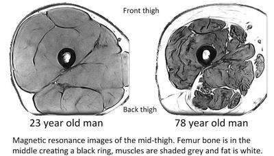 The femur bone is in the middle creating a black ring, muscles are shaded grey and fat is white - Image Credit: Piasecki et al.