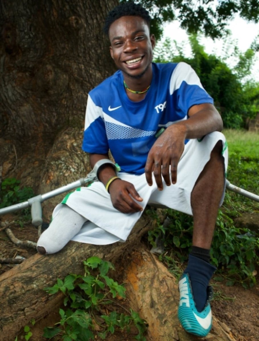 Paul Mensah, amputee footballer and face of the Legs4Africa campaign.