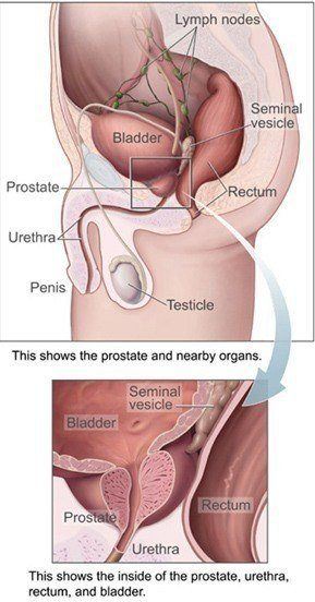 Male anatomy picture showing location of the prostate gland.