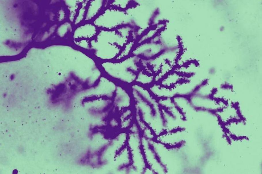 Purkinje cells in the cerebellum, stained and magnified 63 times, revealing fine details of the dendritic spines.