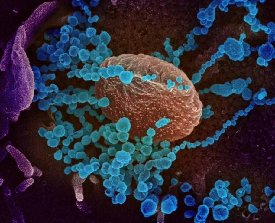 Novel Coronavirus SARS-CoV-2 - This scanning electron microscope image shows SARS-CoV-2 (round blue objects) emerging from the surface of cells cultured in the lab. SARS-CoV-2, also known as 2019-nCoV, is the virus that causes COVID-19. The virus shown was isolated from a patient in the U.S. Image Credit: NIAID-RML