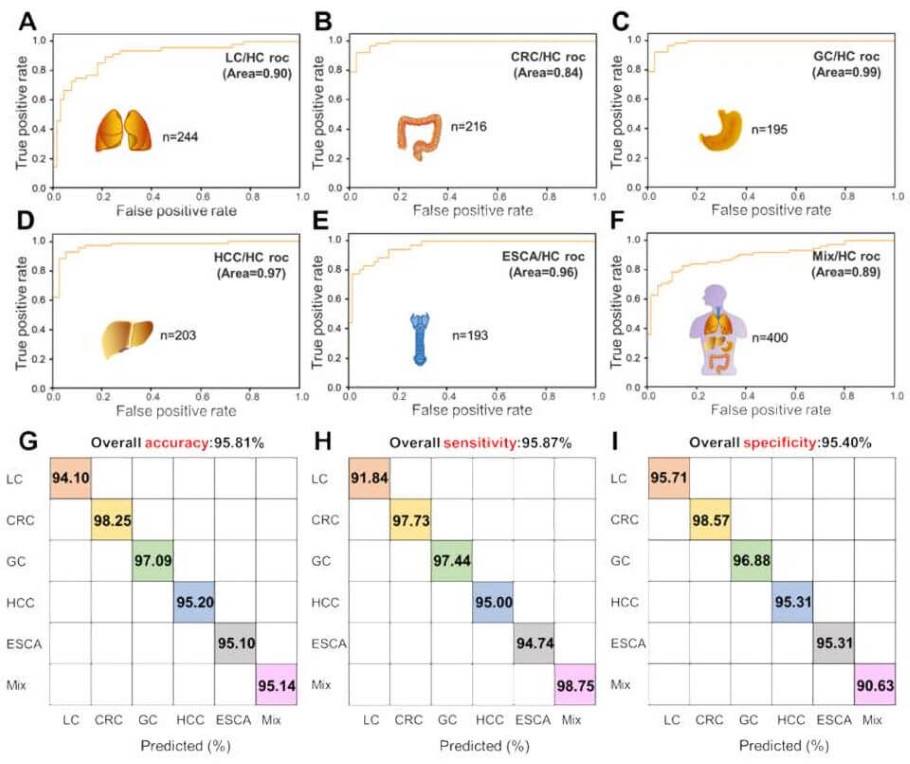 Fig 2. Early screening for four representative cancers by SERS-AICS. (A) The SERS-AICS method could also effectively distinguish common diseases from early cancers in stage I and II with high accuracy. (B) ROC curves with covariance matrices-assisted SVM model for distinguishing 45 common disease patients from 33 early stage of cancer patients about lung. (C) ROC curves with covariance matrices-assisted SVM model for distinguishing 42 common disease patients from 32 early stage of cancer patients about colorectum. (D) ROC curves with covariance matrices-assisted SVM model for distinguishing 39 common disease patients from 36 early stage of cancer patients about gastric. (E) ROC curves with covariance matrices-assisted SVM model for distinguishing 33 common disease patients from 32 early stage of cancer patients about liver. (F) The accuracy, sensitivity and specificity of different common disease/early stage of cancer - Image Credit: Shilian Dong, Dong He, Qian Zhang, Chaoning Huang, Zhiheng Hu, Chenyang Zhang, Lei Nie, Kun Wang, Wei Luo, Jing Yu, Bin Tian, Wei Wu, Xu Chen, Fubing Wang, Jing Hu and Xiangheng Xiao.