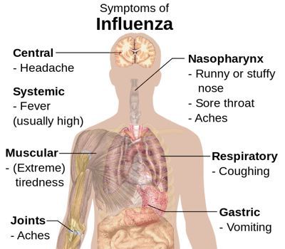 Symptoms of influenza illustration