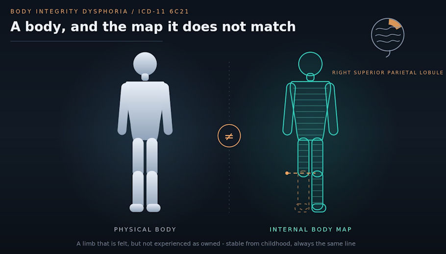 Two stylized human figures side by side. The left figure is solid, labeled physical body. The right figure is a teal wireframe labeled internal body map, with the left leg below the knee shown as a faded dashed outline. A brain icon highlights the right superior parietal lobule.