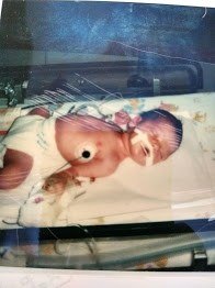 Tricia at 2 days old in the NICU.